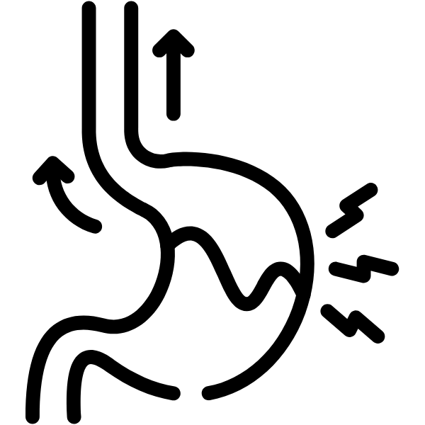 Cirugía Antirreflujo