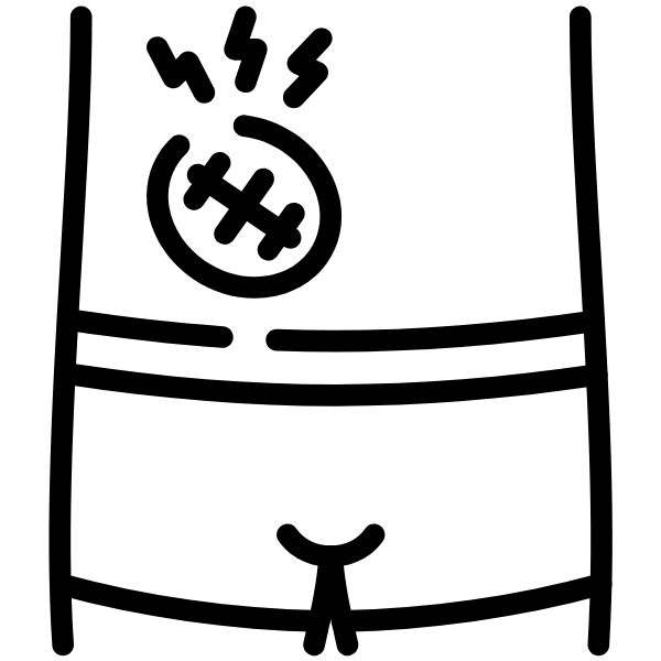 Hernia incisional